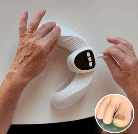 PilzFree Pro Laser